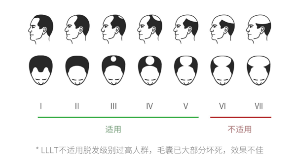 Xiaomi ra mắt mũ kích thích mọc tóc cho người bị hói, cam kết cải thiện trong 2 tuần sử dụng