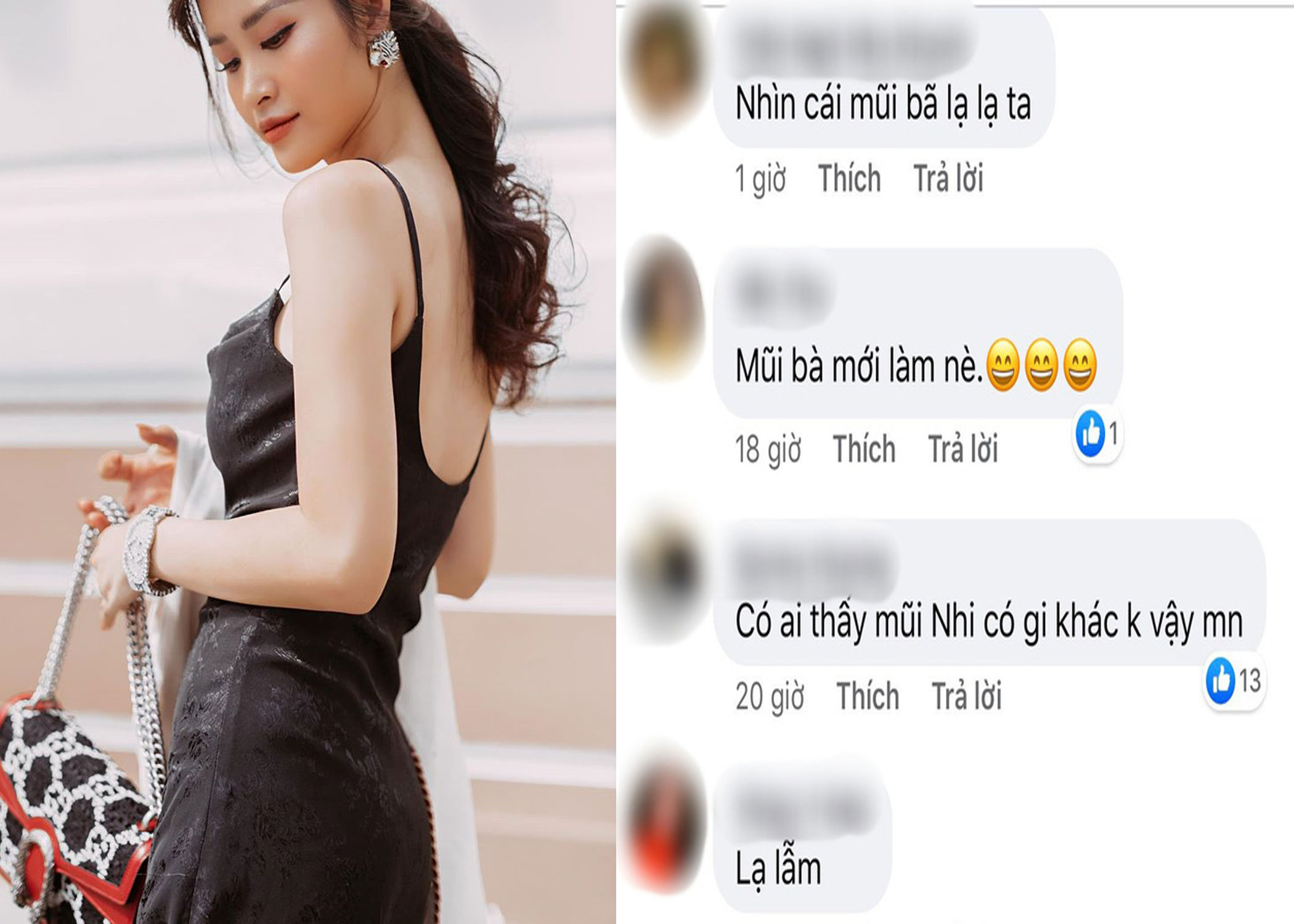 Đ&ocirc;ng Nhi d&iacute;nh nghi vấn can thiệp "dao k&eacute;o" hậu đ&aacute;m cưới khiến CĐM x&ocirc;n xao