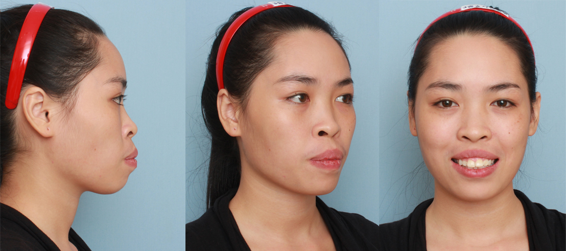 M&agrave;n &lsquo;lột x&aacute;c&rsquo; diện mạo đầy ấn tượng của nữ ch&iacute;nh Người ấy l&agrave; ai m&ugrave;a 3 g&acirc;y sốt CĐM v&igrave; qu&aacute; xinh đẹp