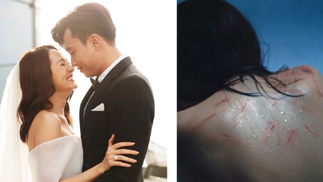 Sao-17-3-bao-anh-dau-kho-vi-bi-bao-hanh-suot-1-thang-lan-ngoc-lo-nhan-sac-that-khi-bi-chup-len