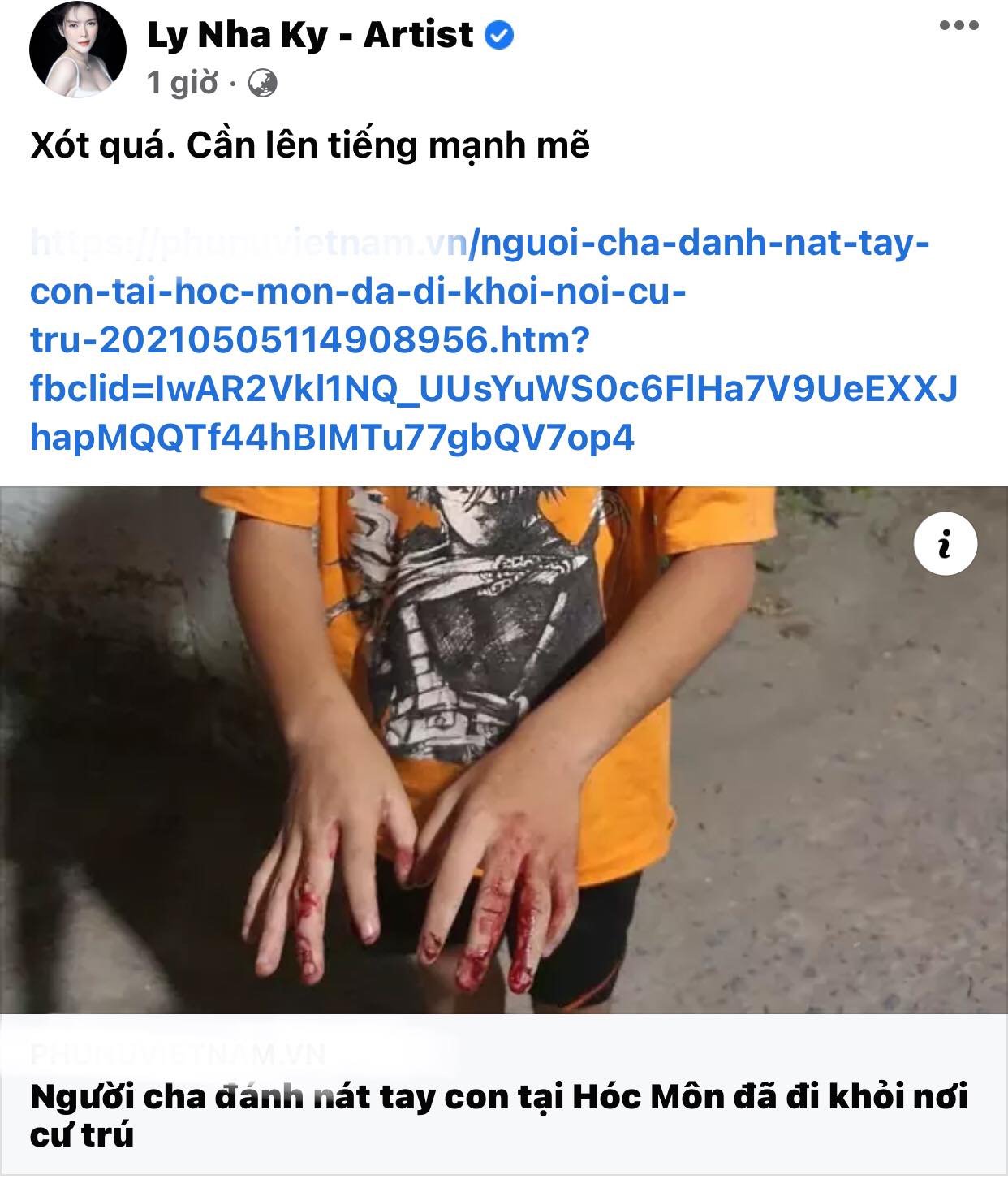 Ly-nha-ky-xot-xa-cam-phan-khi-nhin-thay-canh-be-trai-10-tuoi-bi-bo-ruot-danh-dap-qua-thuong-tam