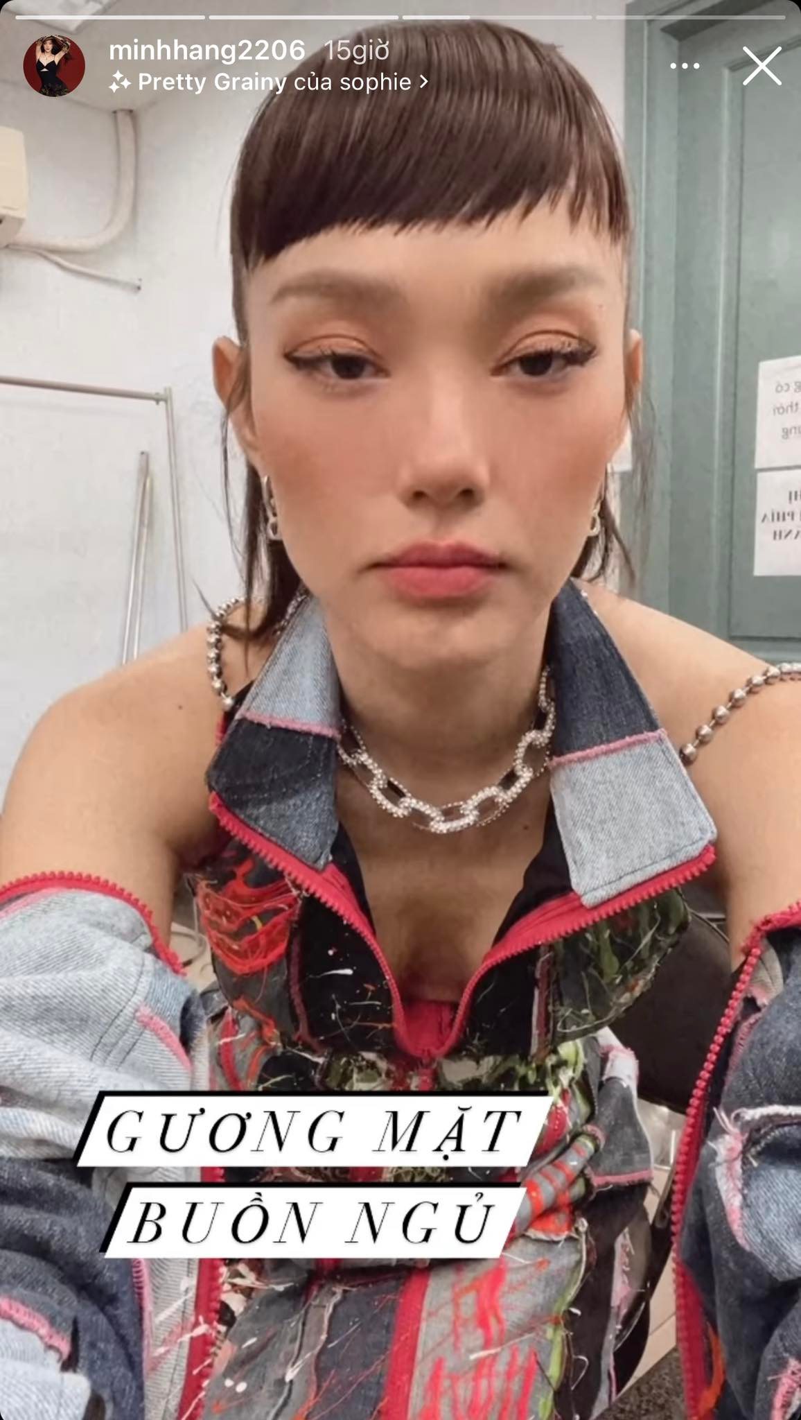 Minh-hang-lo-dien-voi-guong-mat-gay-roc-doi-mat-vo-hon-met-moi-he-lo-nguyen-nhan-gay-lo-lang-1