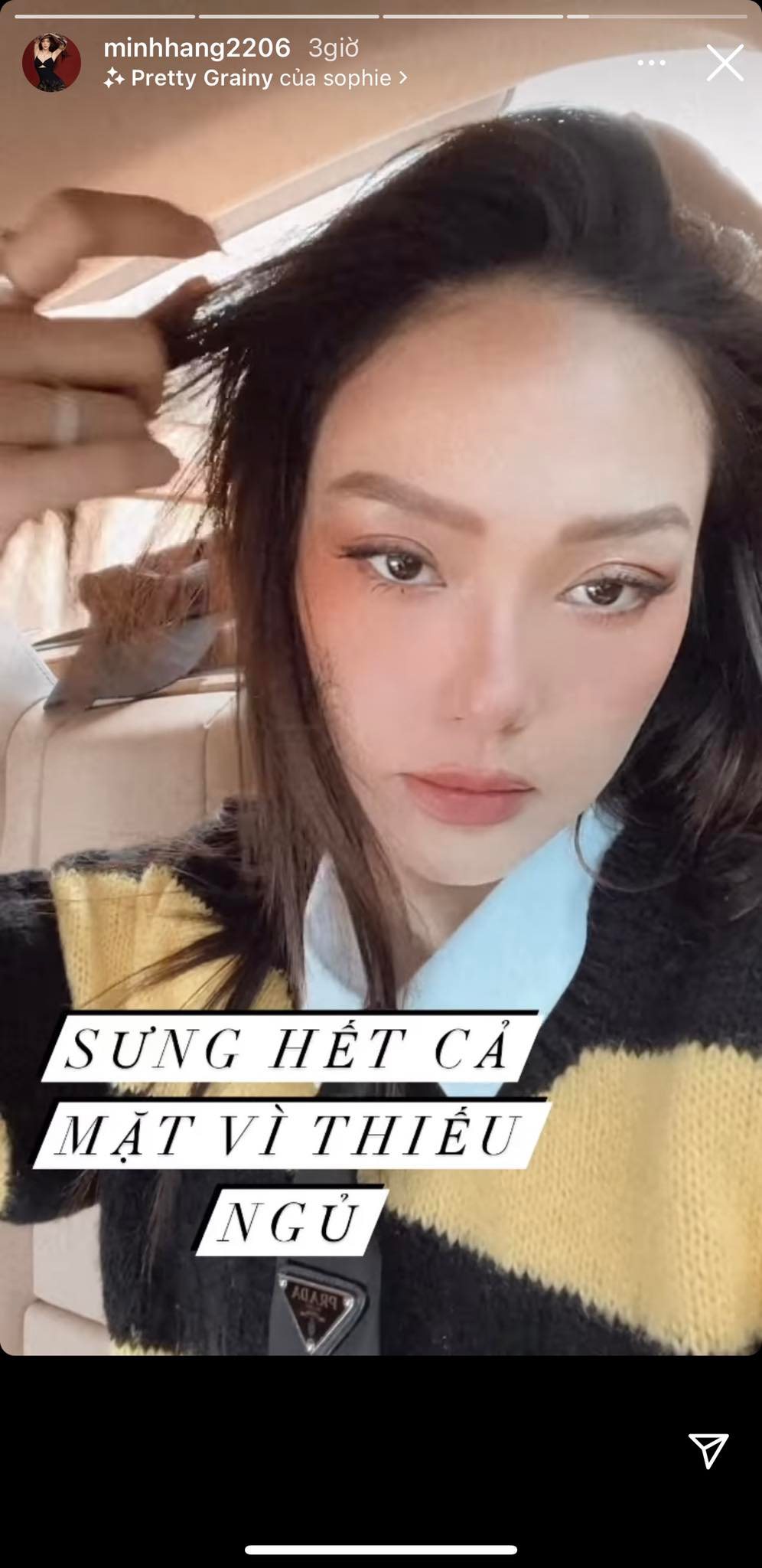 Minh-hang-lo-dien-voi-guong-mat-gay-roc-doi-mat-vo-hon-met-moi-he-lo-nguyen-nhan-gay-lo-lang-2