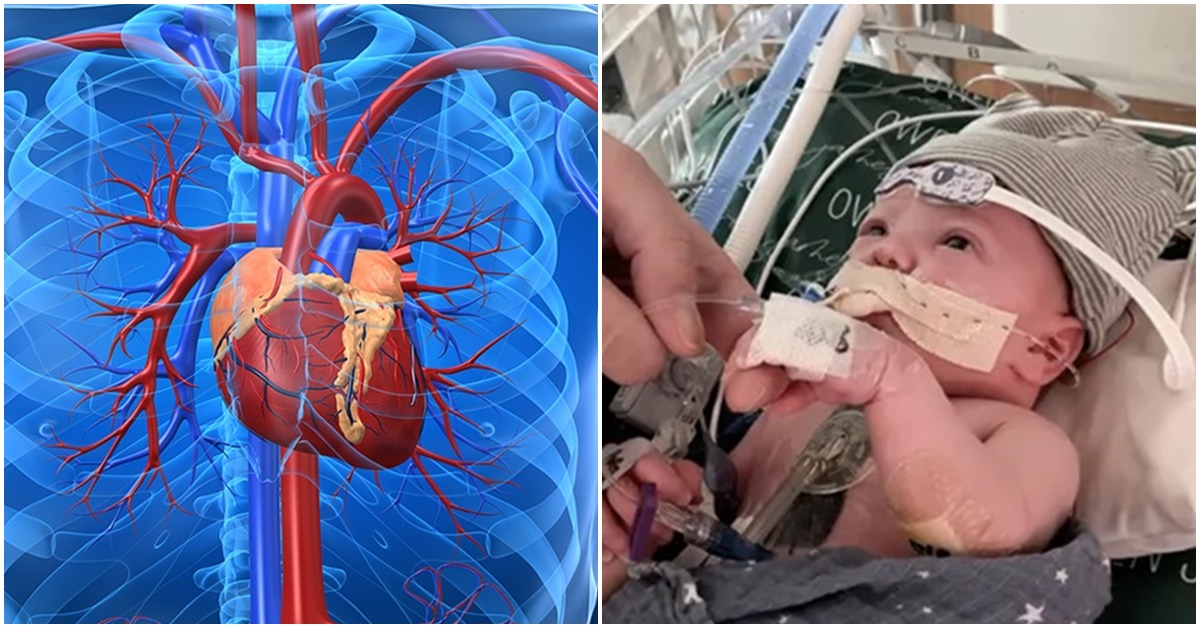 Bé trai ghép tim 1 phần đầu tiên trên thế giới phát triển diệu kì sau hơn 1 năm