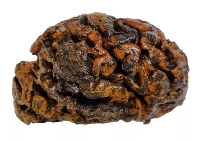 1000-year-old-preserved-human-brain-belgium-1710903347.jpg