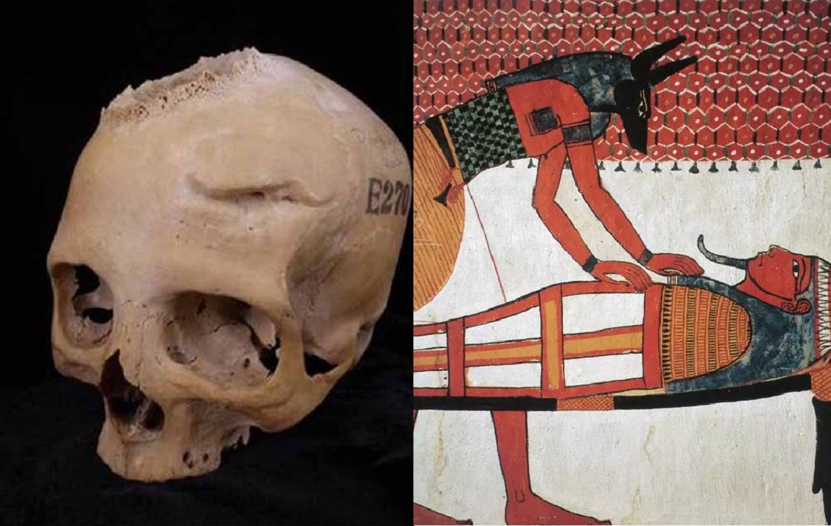 Nền y tế đáng kinh ngạc của Ai Cập: Từ 4.000 năm trước đã thực hiện phẫu thuật điều trị ung thư não?