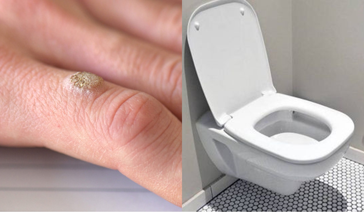 Bác sĩ tiết niệu cảnh báo: 90% bệ toilet công cộng chứa virus HPV, phụ nữ cần làm việc này để tránh lây nhiễm