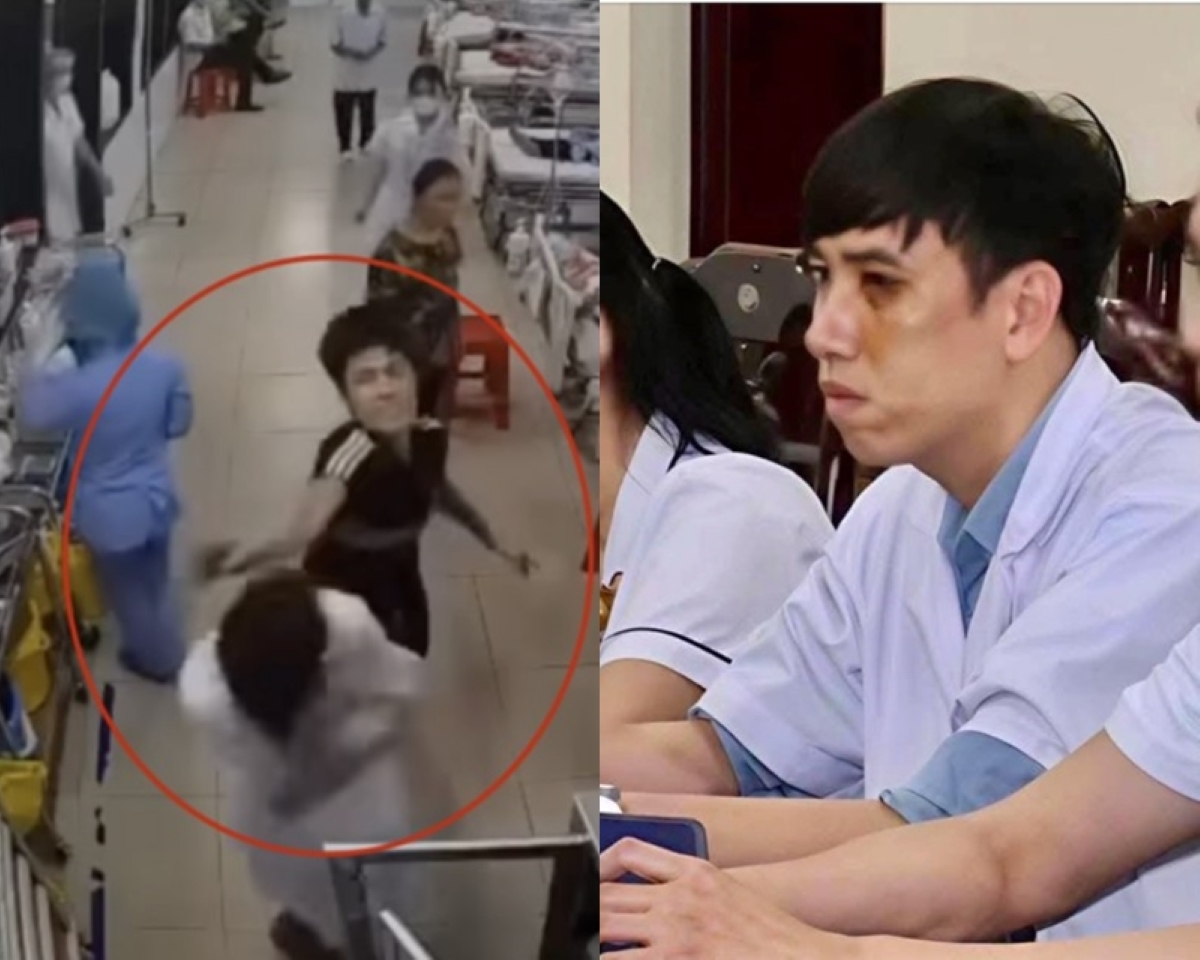 CĐM vừa xót xa vừa \'ứa gan\' nhìn hình ảnh nam điều dưỡng mặt tím bầm nhận lời xin lỗi muộn màng 