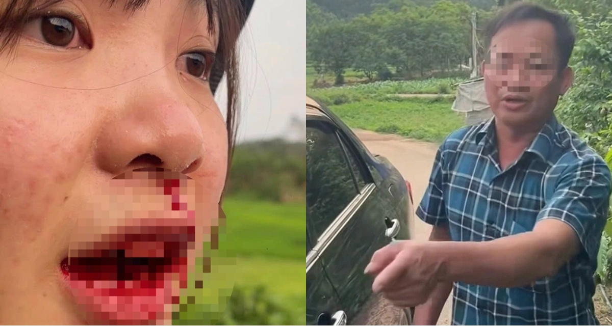 Rộ tin người chặn xe, đánh cô gái 23 tuổi ở Bắc Giang là cán bộ xã, lãnh đạo địa phương nói gì?