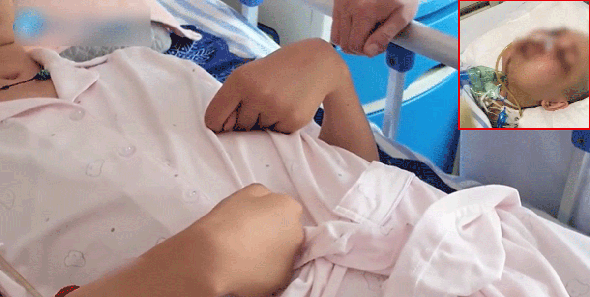 Xót xa vụ việc người mẹ bị đánh đến teo não, mặt biến dạng khi cố bảo vệ con gái 13 tuổi khỏi kẻ trộm