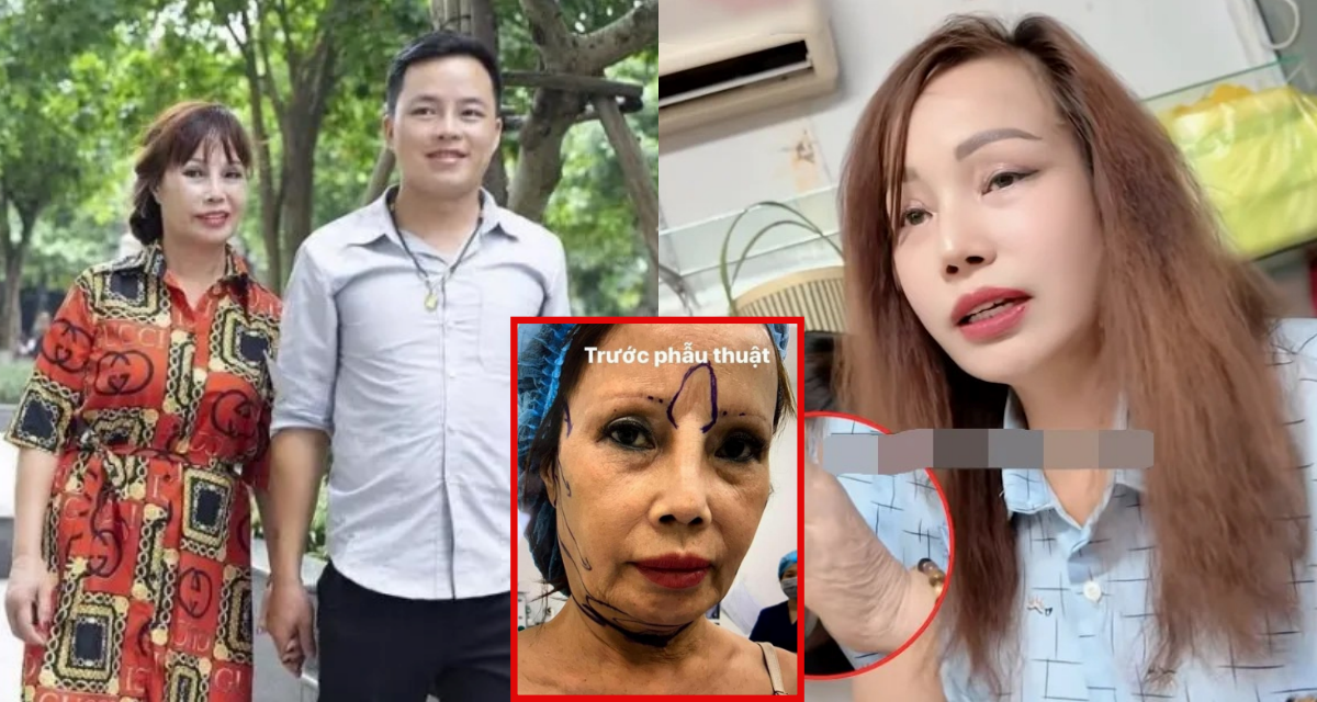 \'Cô dâu Cao Bằng\' lại \'dao kéo\' để xứng với chồng kém 36 tuổi, ngoại hình hiện tại gây chấn động