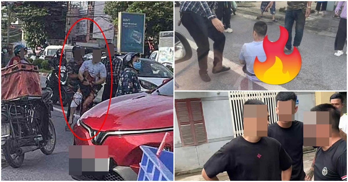 NÓNG: Cập nhật tình hình hiện tại của Tiktoker ở Thái Nguyên bị chém gần lìa bàn tay, công an vào cuộc