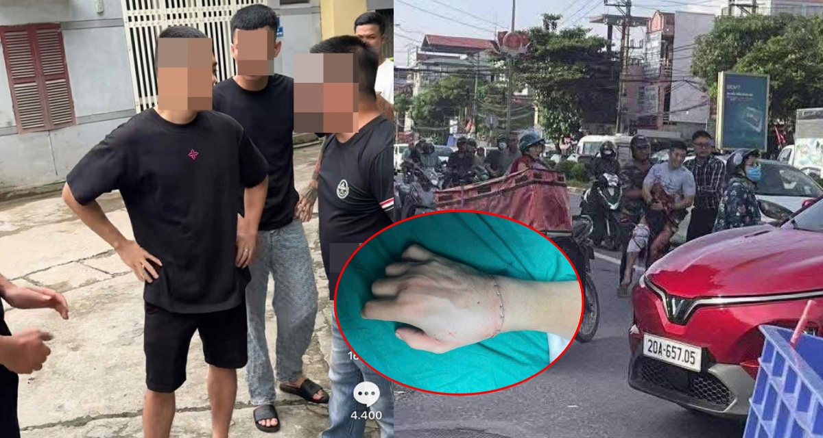 Bác sĩ hé lộ tình trạng sau ca mổ 6 tiếng của TikToker Hà Lits bị chém lìa tay ở Thái Nguyên