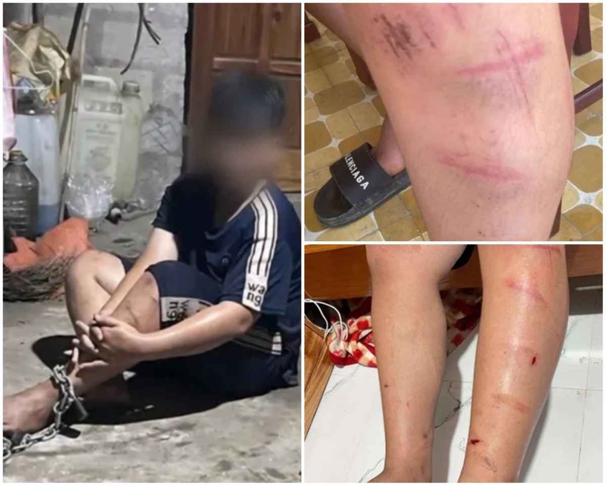 Hé lộ lý do \'chấn động\' khiến người đàn ông xích chân rồi hành hung dã man cháu bé 14 tuổi ở Huế