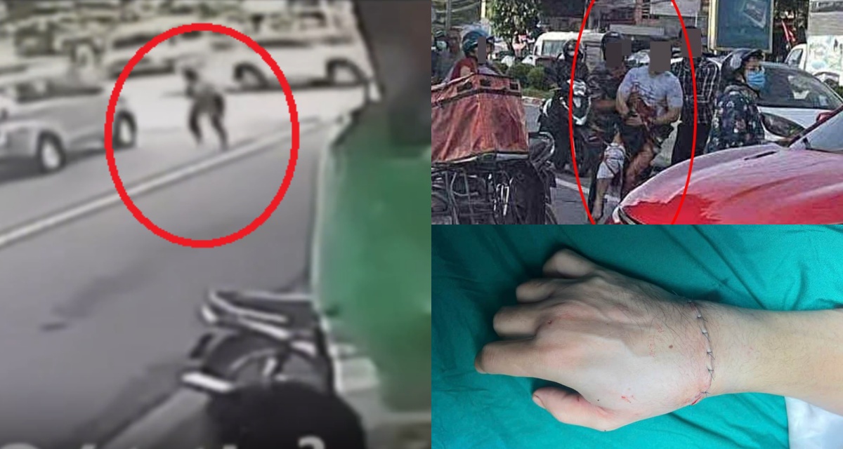 Camera ghi lại cảnh Tiktoker Hà List bị chém lìa tay: 30 giây ‘ra tay’ đầy lạnh lùng giữa phố 