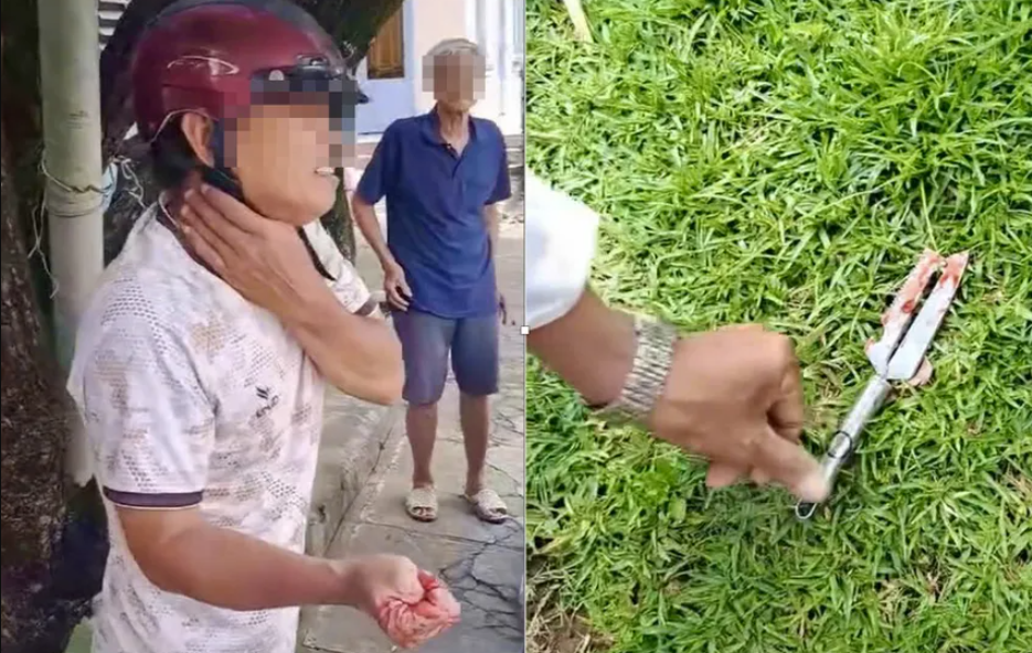 Vụ trấn lột Đồng Nai: Tên cướp lấy cọc tiền xong đâm vào đùi tài xế ô tô, tấn công cả người truy bắt