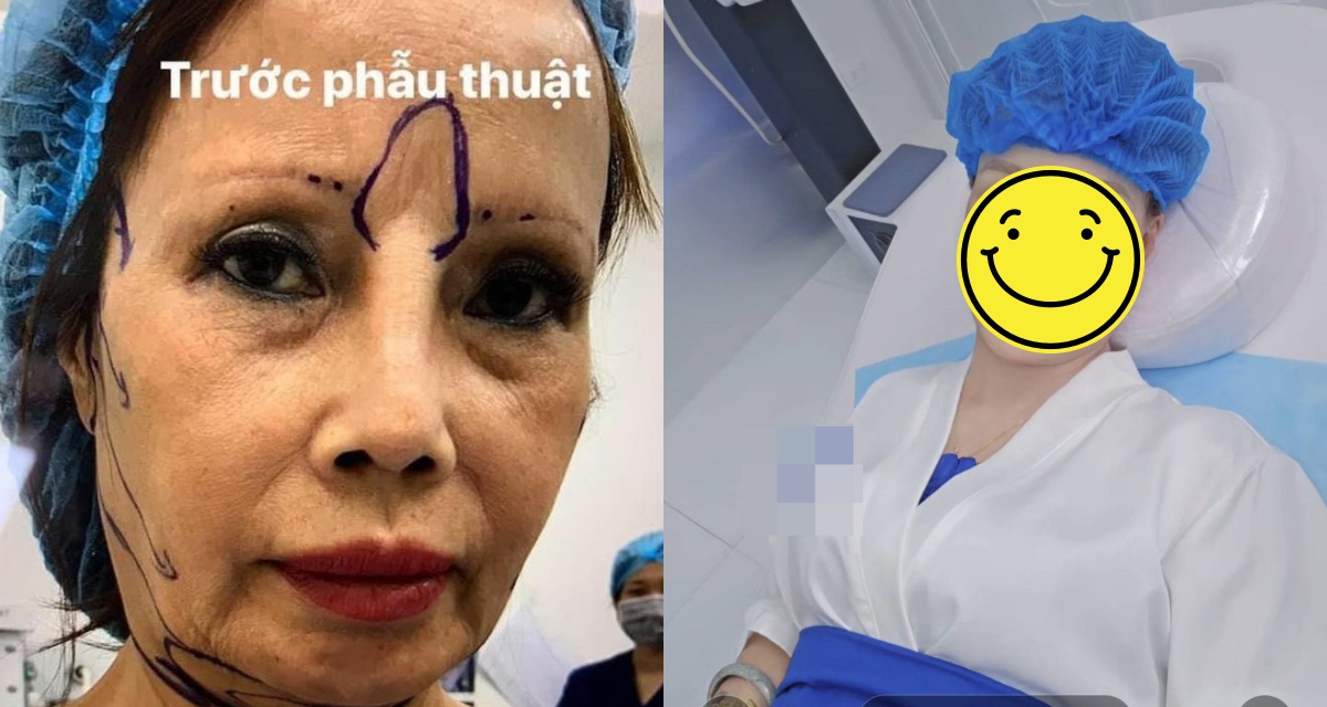 Cô dâu Thu Sao lại lên bàn mổ ở tuổi U70: Diện mạo hậu thẩm mỹ gây tranh cãi dữ dội!