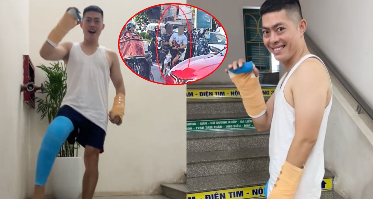 Tiktoker Hà List khoe khoảnh khắc đứng dậy, hành trình phục hồi sau biến cố bị chém lìa tay ở Thái Nguyên