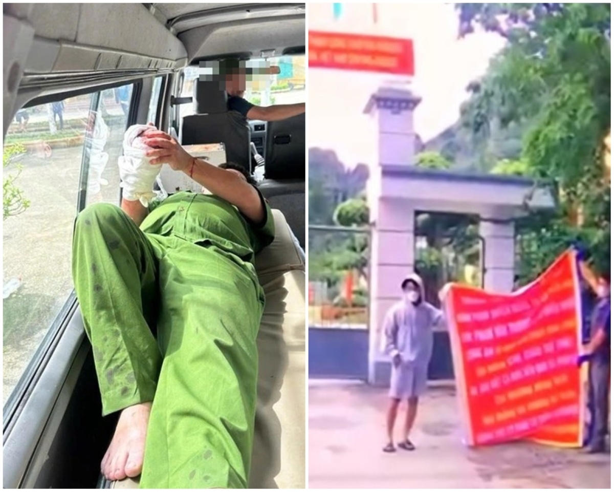 Tình hình sức khỏe cán bộ Công an bị nhóm người gây rối trước Trung tâm cai nghiệm đâm trọng thương