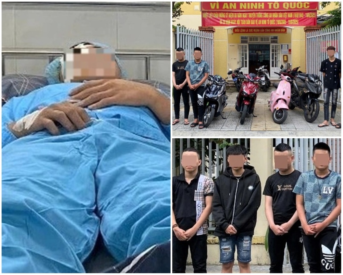 Lý do khó chấp nhận của nhóm thanh niên đánh người đến mù vĩnh viễn: Tất cả chỉ vì nhìn nhầm?