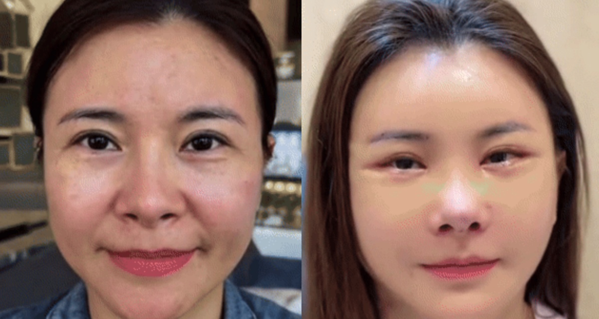 Diễn viên Kim Oanh gây tranh cãi với diện mạo mới sau ca ‘dao kéo’ toàn mặt: Chính chủ lên tiếng đáp trả