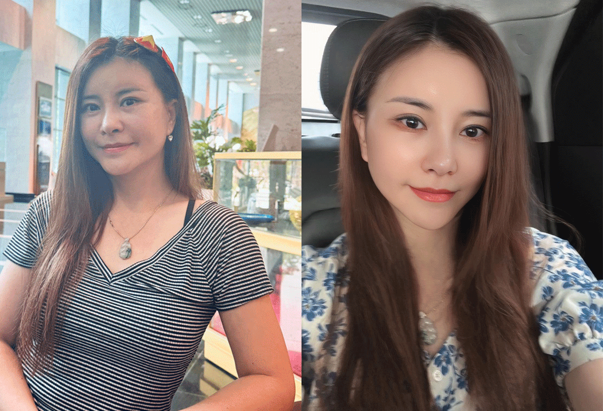 Diễn viên Kim Oanh - ‘vợ anh Núi’ có tuyên bố gây sốt sau khi công khai việc phẫu thuật ở tuổi 50