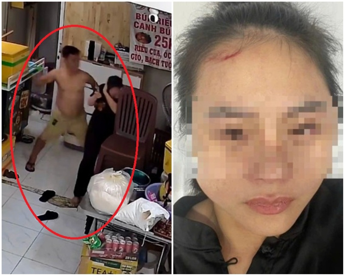Nguyên nhân khó chấp chấp nhận vụ người phụ nữ bị nam chủ nhà đánh đập dã man tại quán ăn ở TPHCM