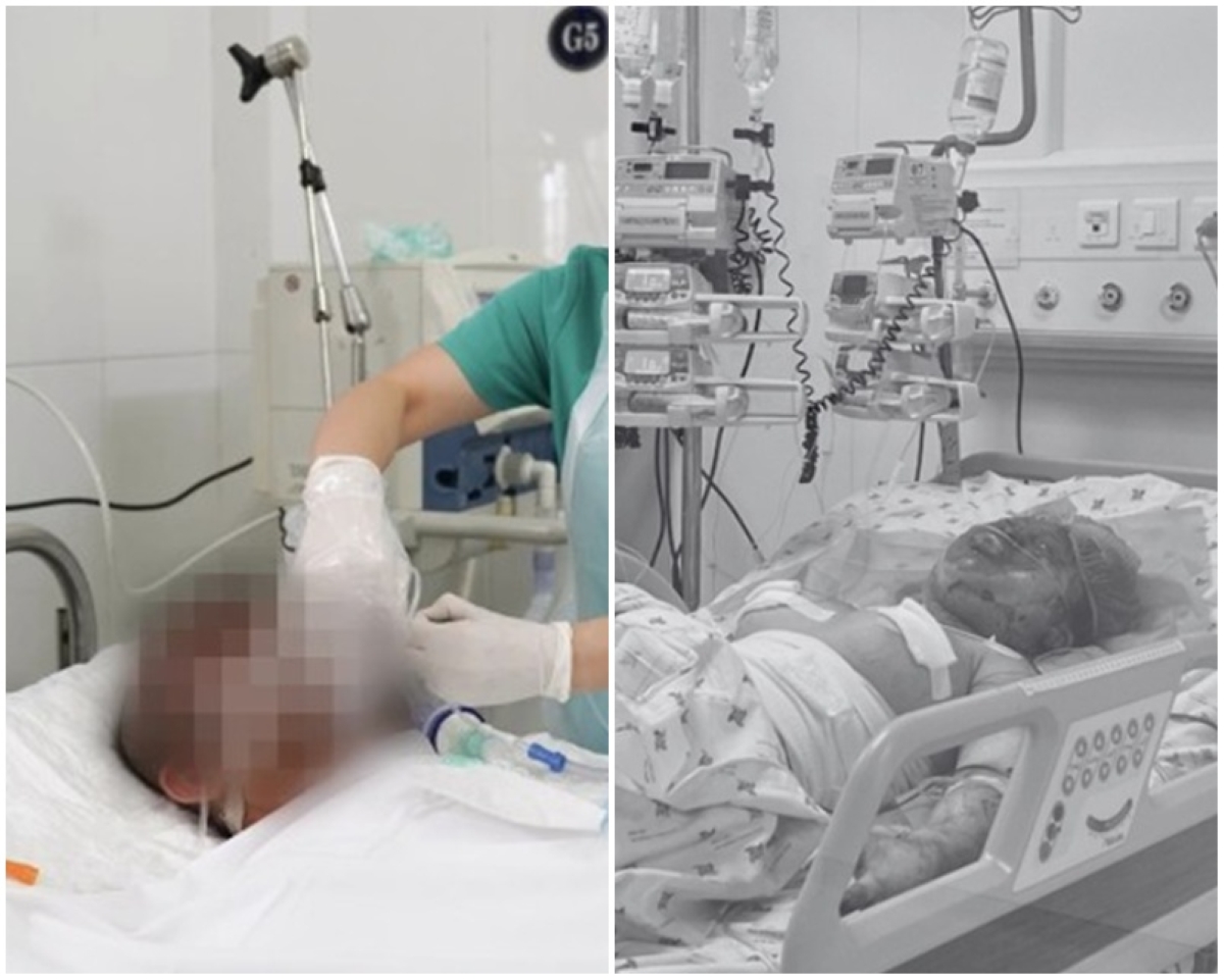 Vụ chồng tưới xăng đốt vợ cũ và 2 con nhỏ chấn động ở Tây Ninh: 1 người đã tử vong vào sáng nay
