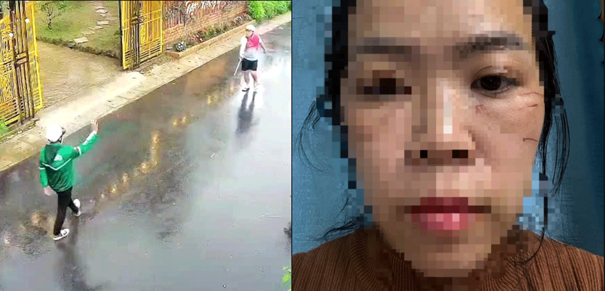 Lâm Đồng: Chi tiết gây phẫn nộ vụ chồng rủ nhóm người chặn đường đánh vợ đến mức phải nhập viện