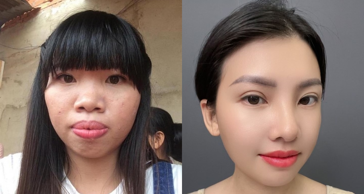 ‘Thị nở tái sinh’ Quách Phượng tiếp tục trùng tu nhan sắc, diện mạo mới thay đổi ngỡ ngàng