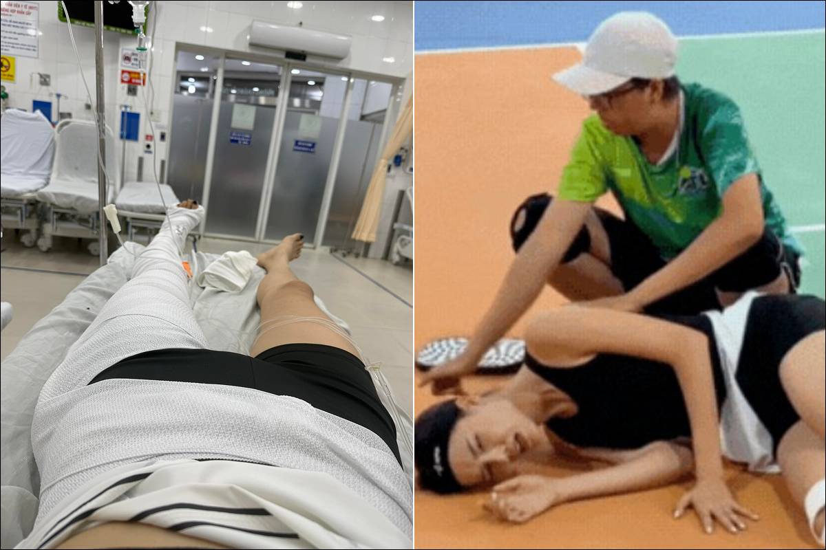 Siêu mẫu Kỳ Hân lộ vết sẹo dài khó tin sau tai nạn kinh hoàng trên sân Pickleball