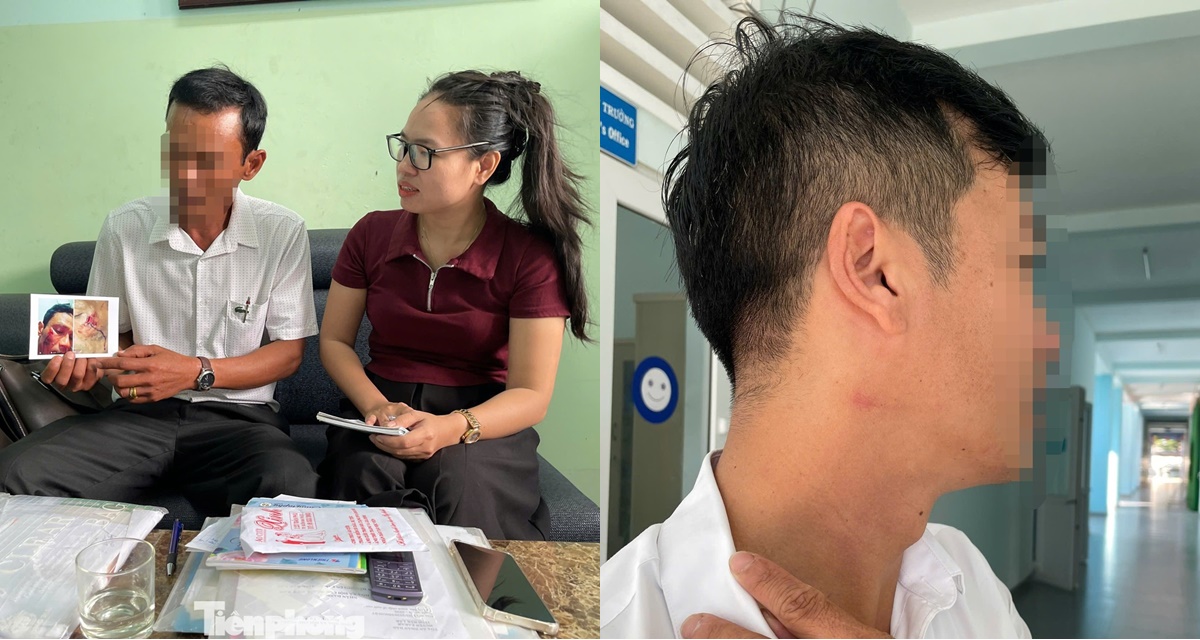 Thầy giáo ‘cá biệt’ đánh học sinh, bóp cổ đồng nghiệp giải thích bất ngờ, tố từng bị đánh hội đồng