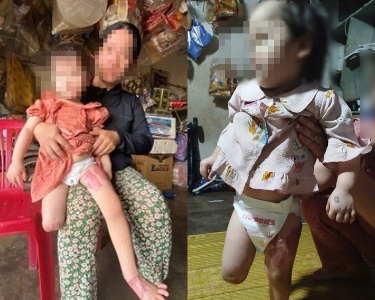 Diễn biến mới vụ xe tải cuốn cháu bé 3 tuổi hỏng 2 chân ở Gia Lai: Công an xem xét lại đơn kiến nghị