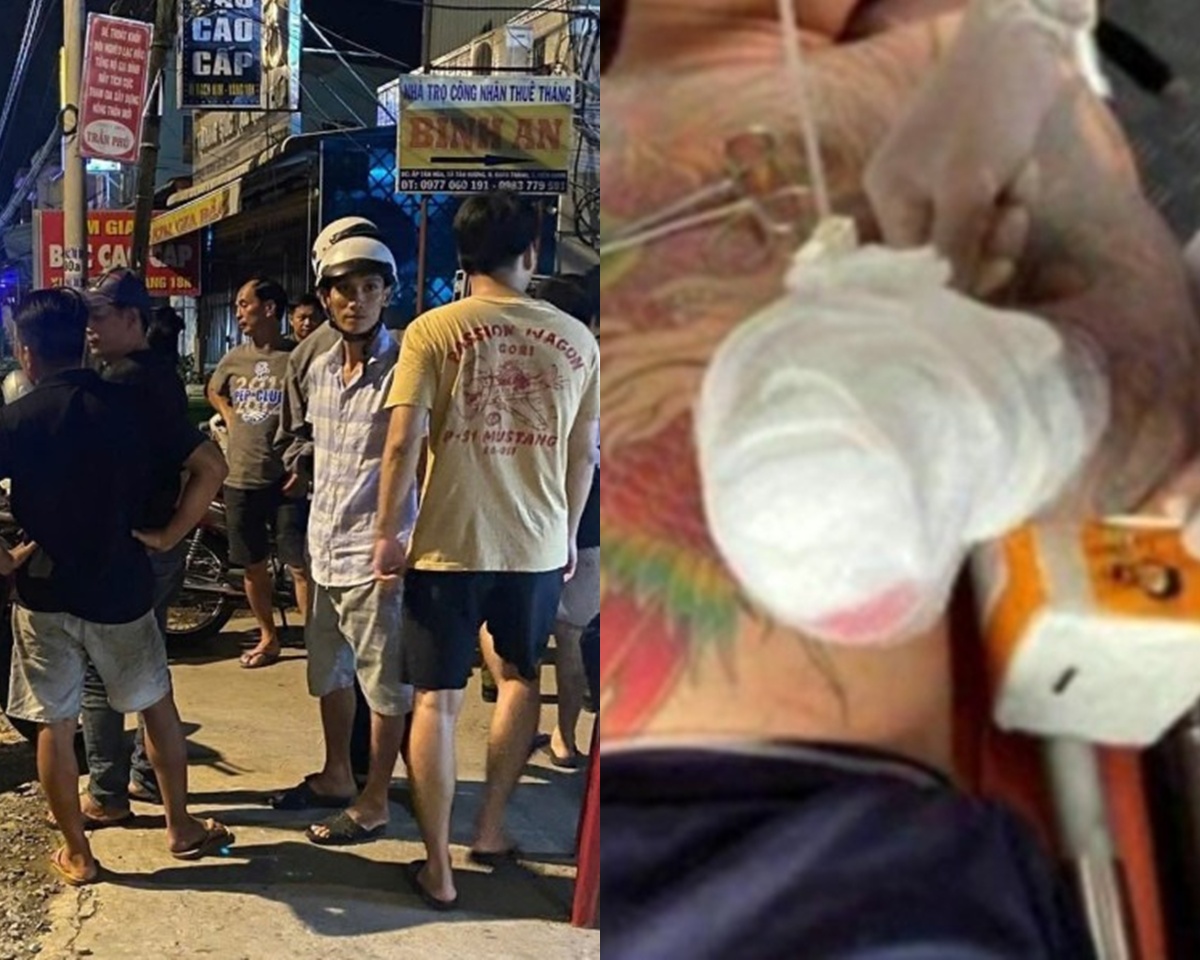 Ghen tuông do vợ bị người khác trêu ghẹo, đối tượng ở An Giang liền chém đứt lìa tay \'tình địch\'