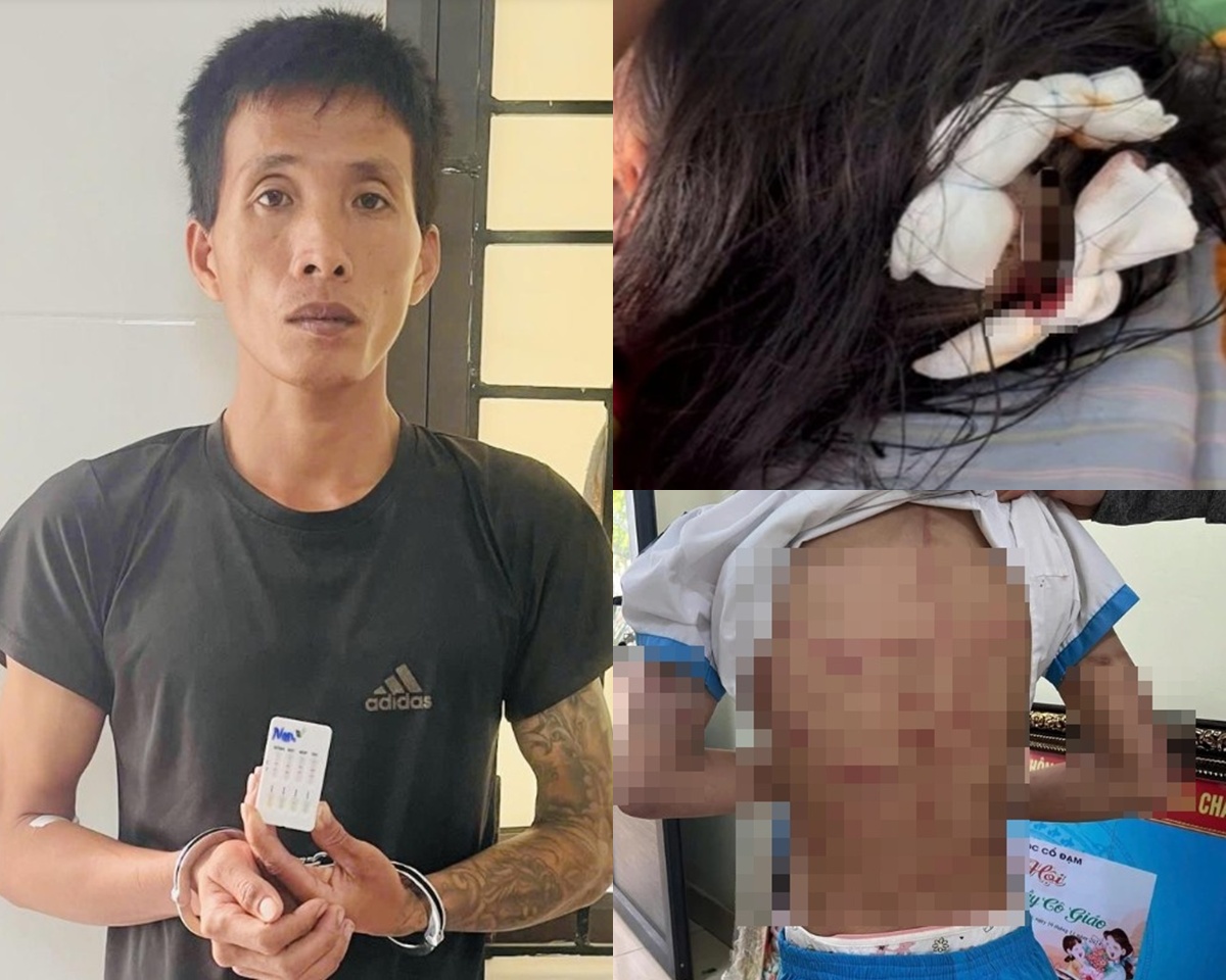 Lời khai khó chấp nhận của cha dượng bạo hành bé gái lớp 5 ở Hà Tĩnh: Nguyên nhân đến từ nhà vợ