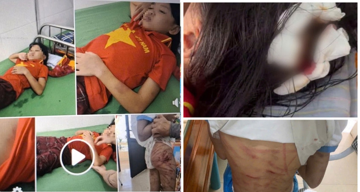 Lộ diện người cha dượng bạo hành bé gái lớp 5 ở Hà Tĩnh, hé lộ nguồn cơn và tình tiết gây phẫn nộ