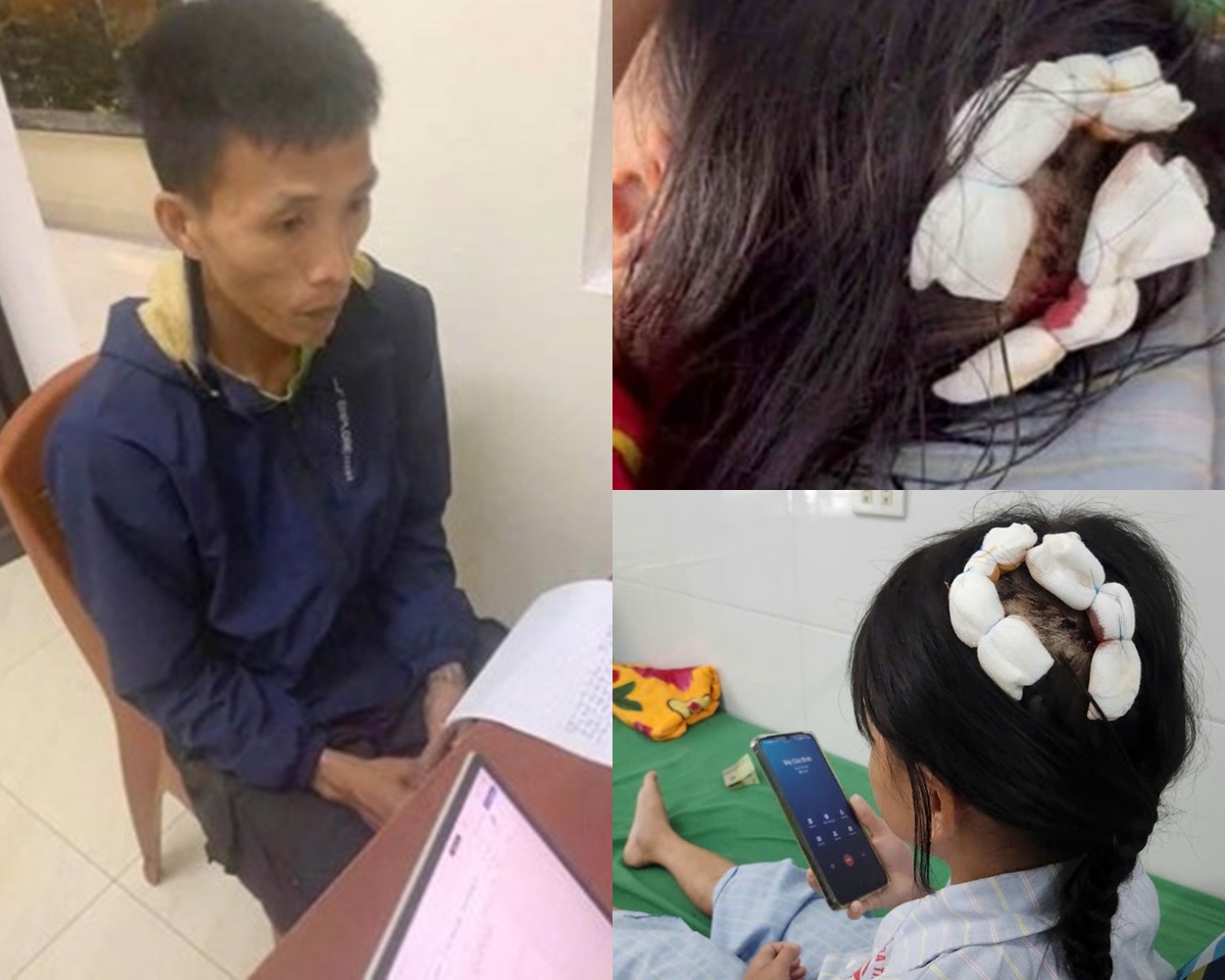 Mức án nặng, có thể kịch khung dành cho gã cha dượng dùng búa bạo hành con riêng của vợ ở Hà Tĩnh