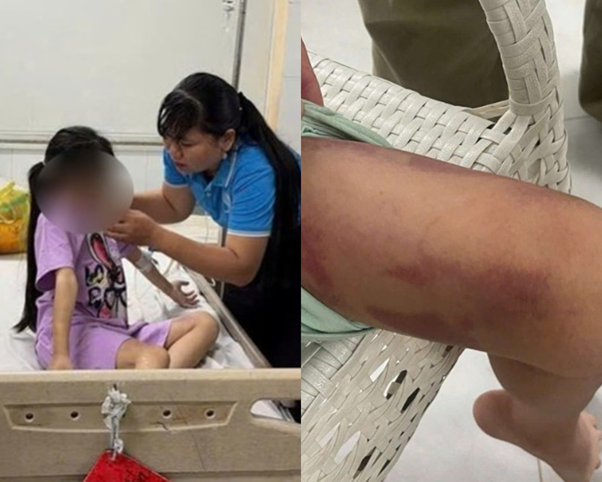 Tạm giữ mẹ ruột 25 tuổi và bạn trai 19 tuổi đánh đập cháu bé ở TP.HCM đến mức phải nhập viện