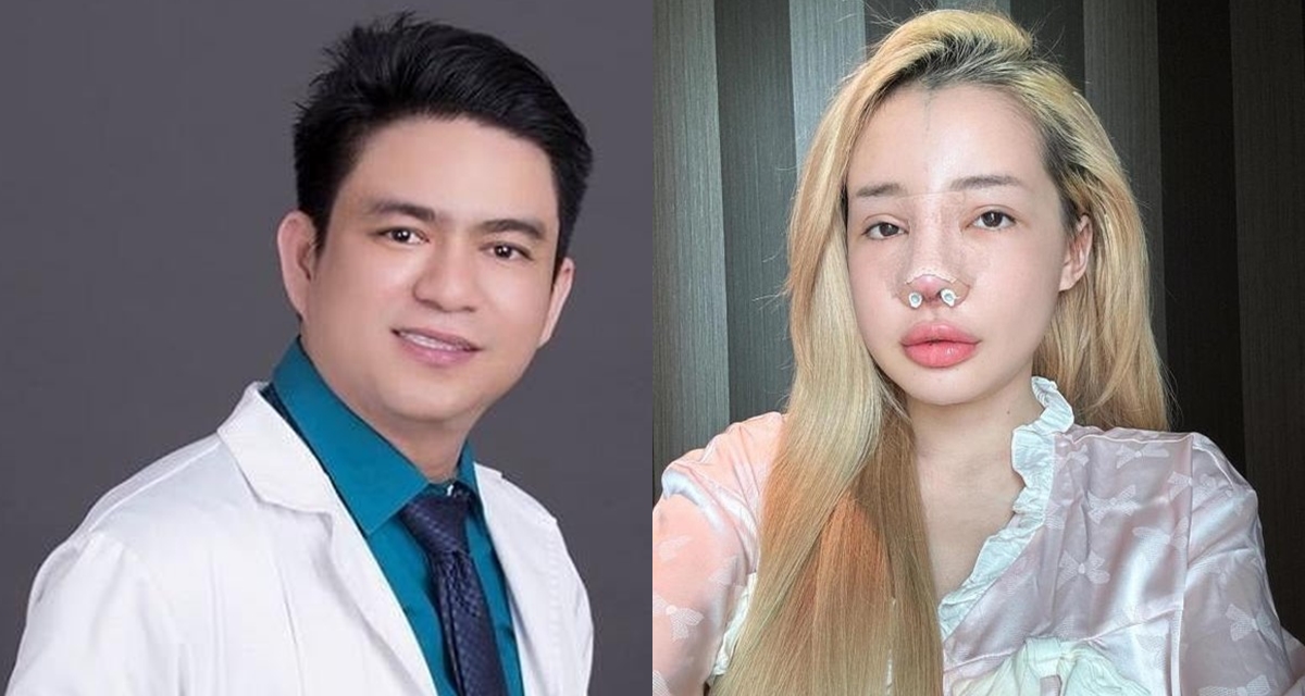Thực hư thông tin bác sĩ Chiêm Quốc Thái là người làm biến dạng mũi của Ngân 98