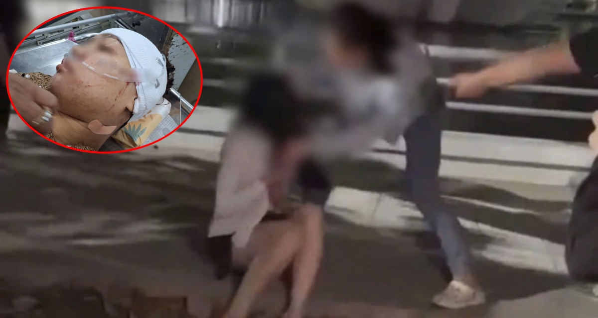 Vụ rạch mặt ở Đồng Tháp: Danh tính người ra tay, hé lộ tình tiết xuất phát từ ‘ghen tuông’?