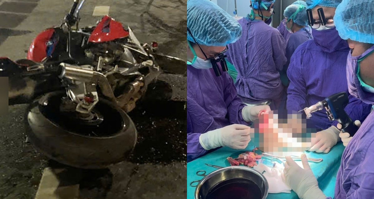 Hành trình nối chân cho nữ sinh 19 tuổi sau tai nạn với mô tô phân khối lớn: Tiết lộ ‘thời gian vàng’ để nối chi thể