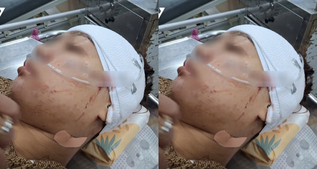 Lời khai của nữ cán bộ phường cầm dao rạch mặt tình địch vì ghen tuông ở Đồng Tháp, gia đình có động thái lạ