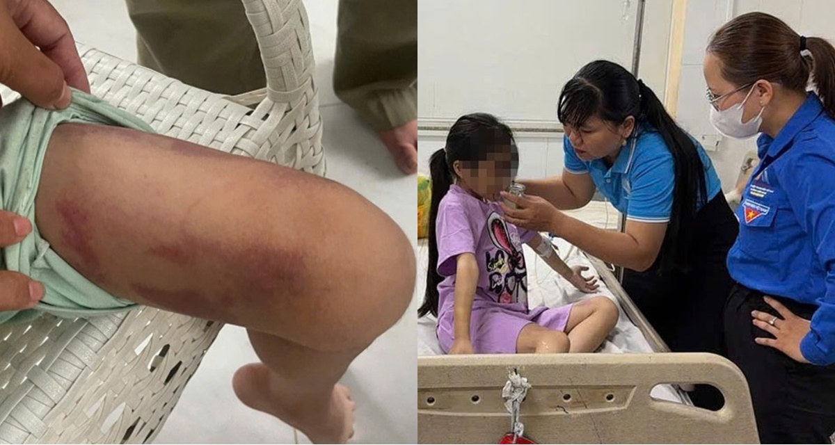 Thân thế gây phẫn nộ của 2 người vừa bị bắt vì bạo hành cháu bé 9 tuổi, bắt nhúng lưỡi vào nước sôi