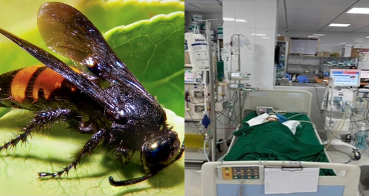 Bé gái bị ong vò vẽ đốt hơn 50 nốt, nhập viện trong nguy kịch, sau nửa tháng xuất hiện điều kỳ diệu