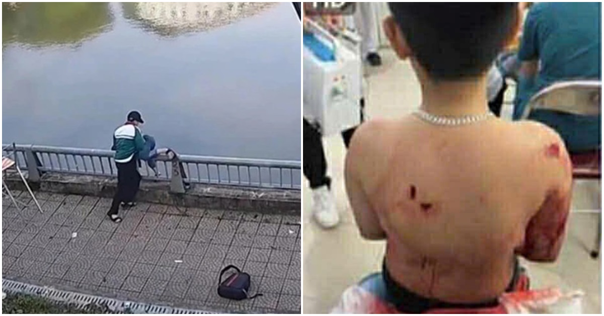 Xôn xao bài viết được cho là của bố nam sinh lớp 8 bị bạn hất xuống hồ nước bức xúc tiết lộ sự thật dã man 