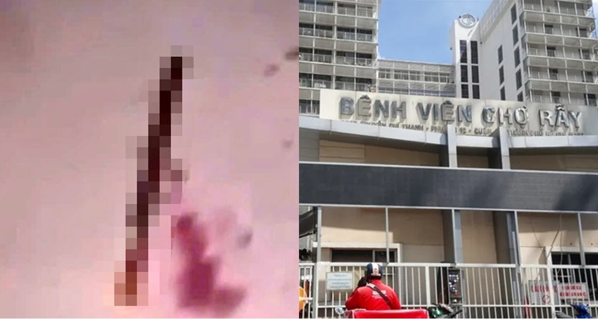 Nguyên nhân thanh niên 17 tuổi bị chém đứt lìa bàn tay ở Lâm Đồng, cập nhật tình hình nạn nhân