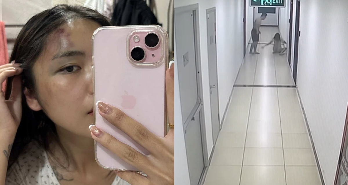 Camera ghi lại cảnh chồng đánh vợ chấn động não vì không về sớm nấu cơm, thái độ nhà chồng gây sốc