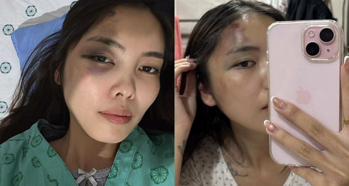 Người vợ bị chồng đánh chấn động não hé lộ tình tiết phẫn nộ, vợ cũ ra mặt vạch trần bản chất người đàn ông