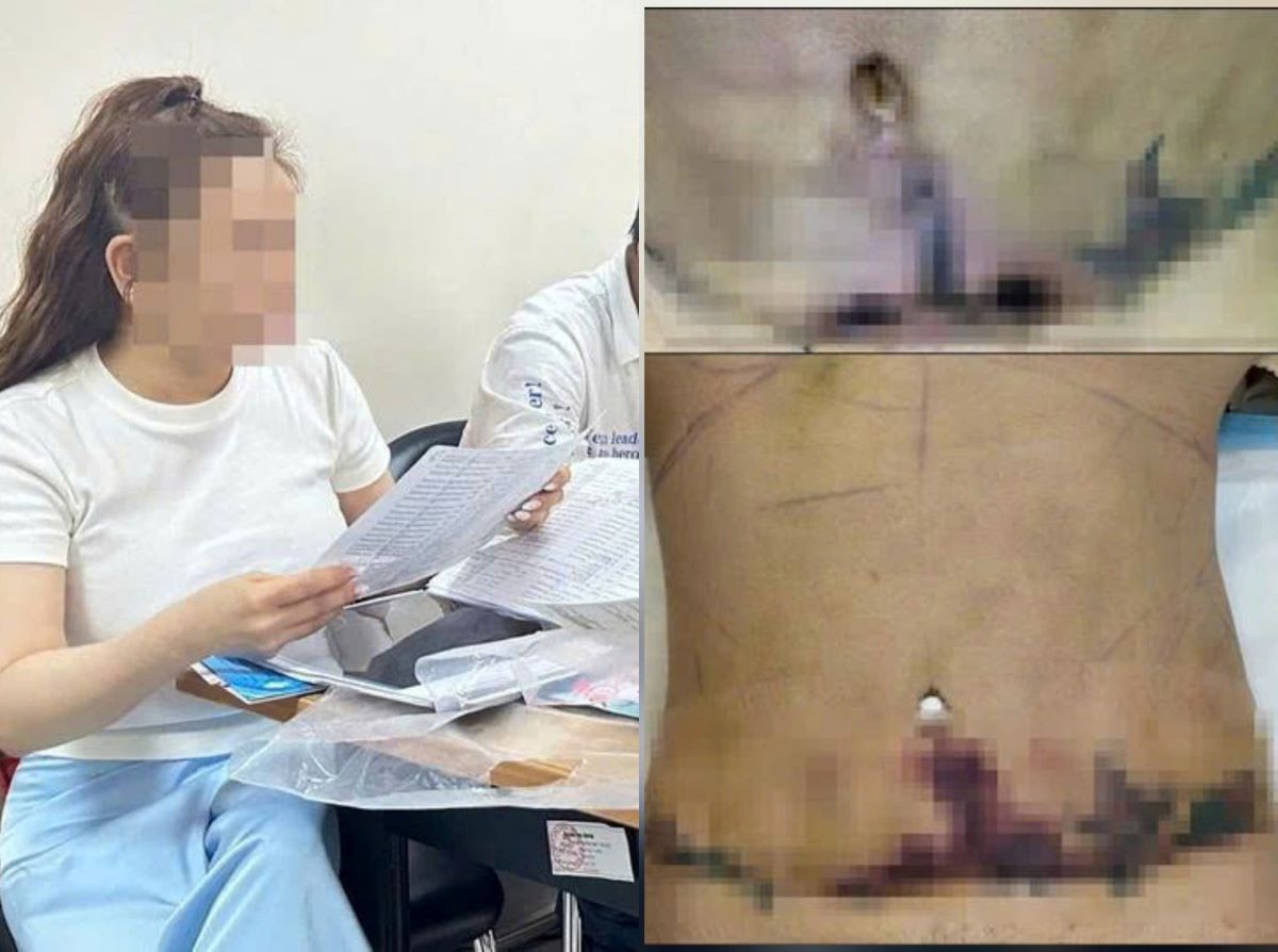 Bệnh viện Thẩm mỹ JT Angel bị tố, hé lộ những góc khuất \'công nghệ\' kinh hoàng