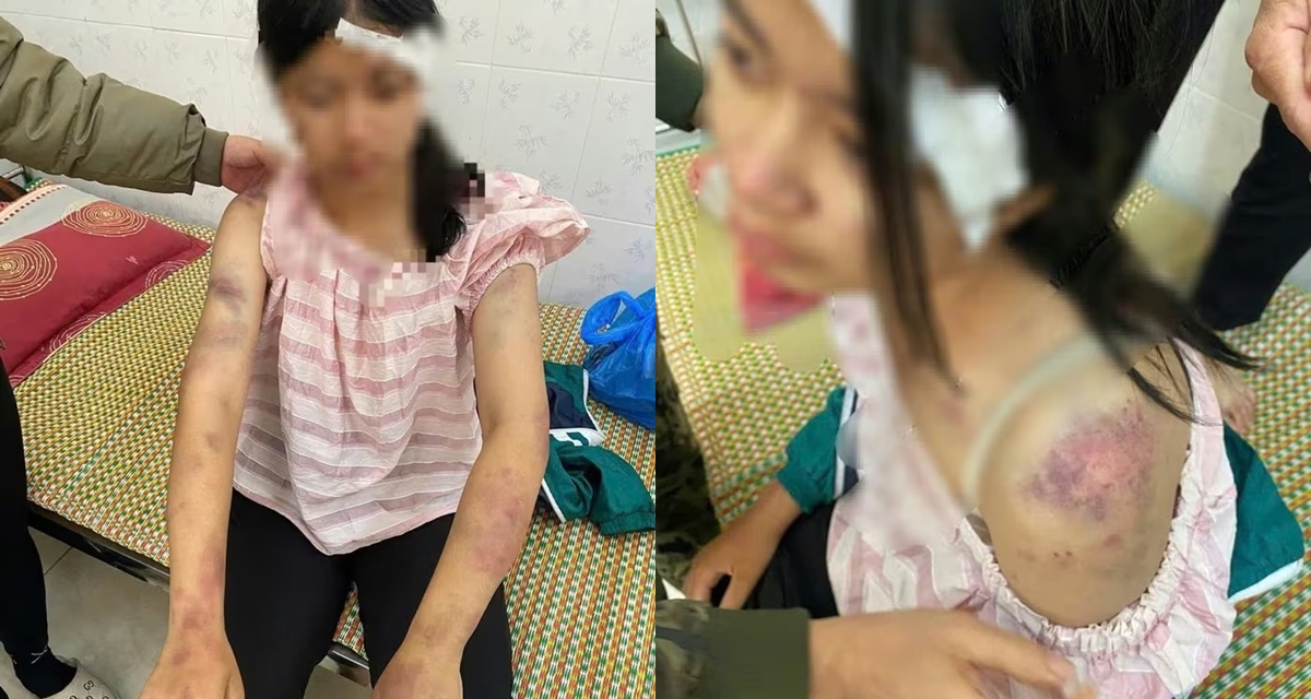 Chân dung bà nội và hai người đàn ông tra khảo, đánh đập cháu gái 13 tuổi dã man, lý do gây căm phẫn